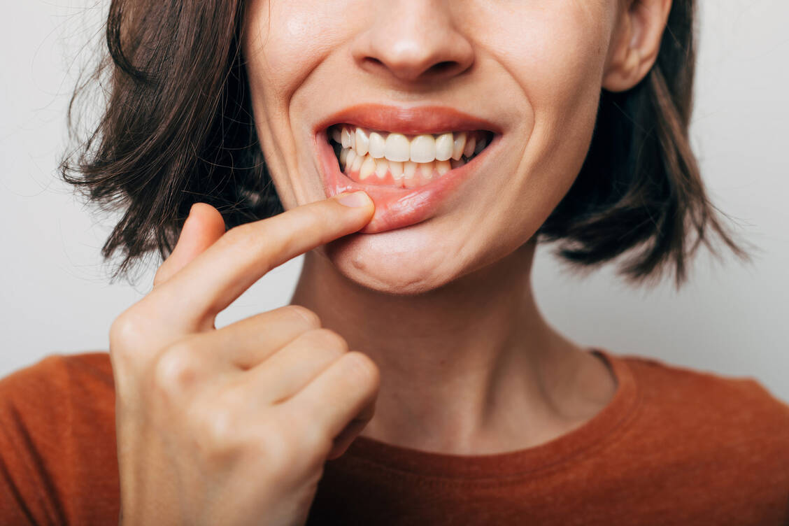 Verletzungen und Entzündungen der Mundschleimhaut sind oft sehr schmerzhaft. / Foto: Adobe Stock/Maksym Povozniuk