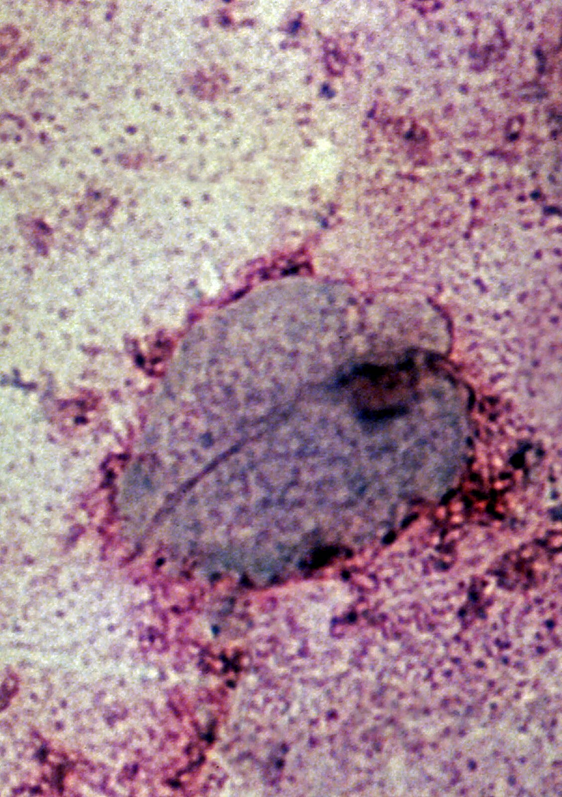 Trichomonas vaginalis soll weltweit für mehr als 150 Millionen Infektionen verantwortlich sein. / Foto: Your Photo Today