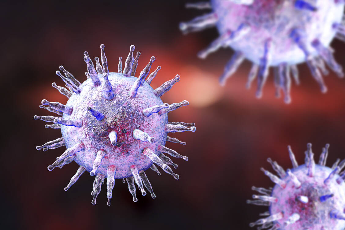 Das Epstein-Barr-Virus ist vor allem als Erreger des Pfeifferschen Drüsenfiebers bekannt. Es könnte aber auch eine Rolle bei der Entstehung der Multiplen Sklerose spielen. / Foto: Shutterstock/Kateryna Kon