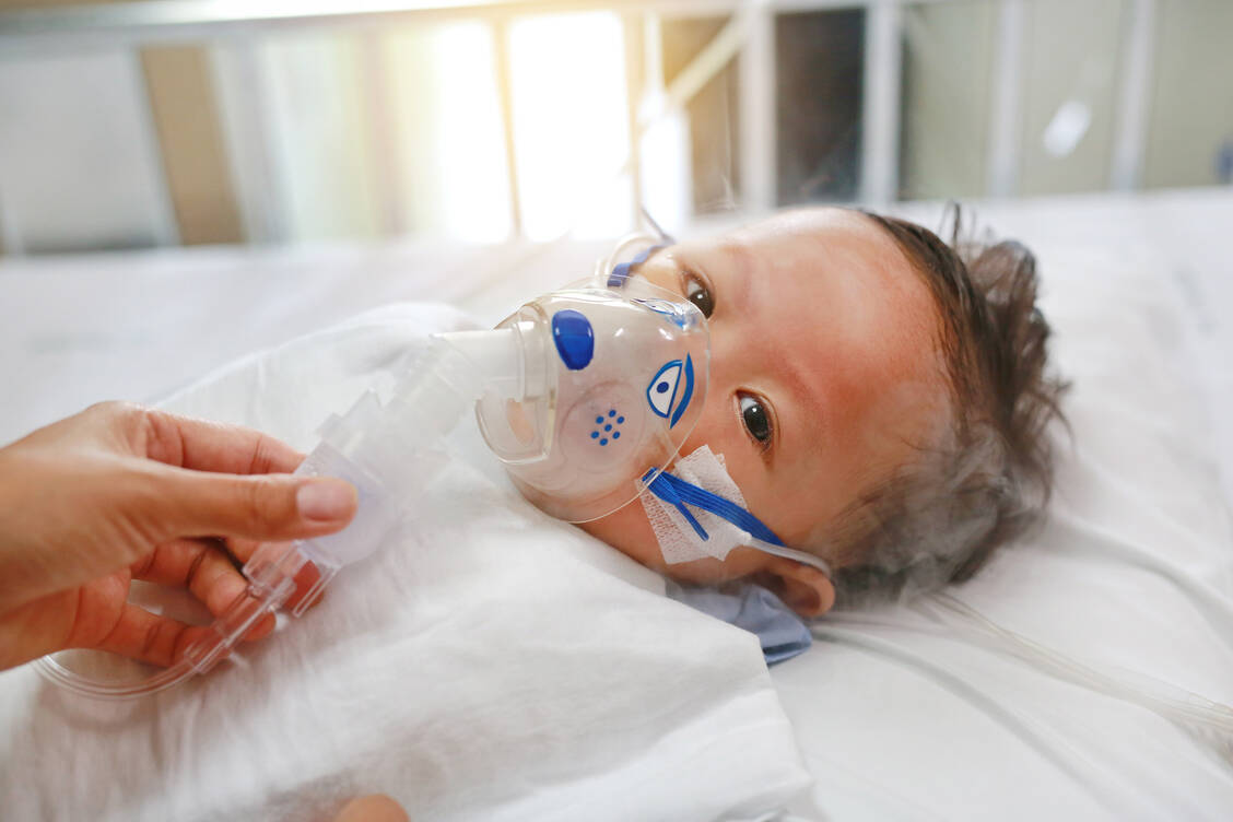 RSV kann vor allem bei Säuglingen schwere Atemwegserkrankungen hervorrufen, die eine Beatmung nötig machen. / Foto: Adobe Stock/parinya agsararattananont
