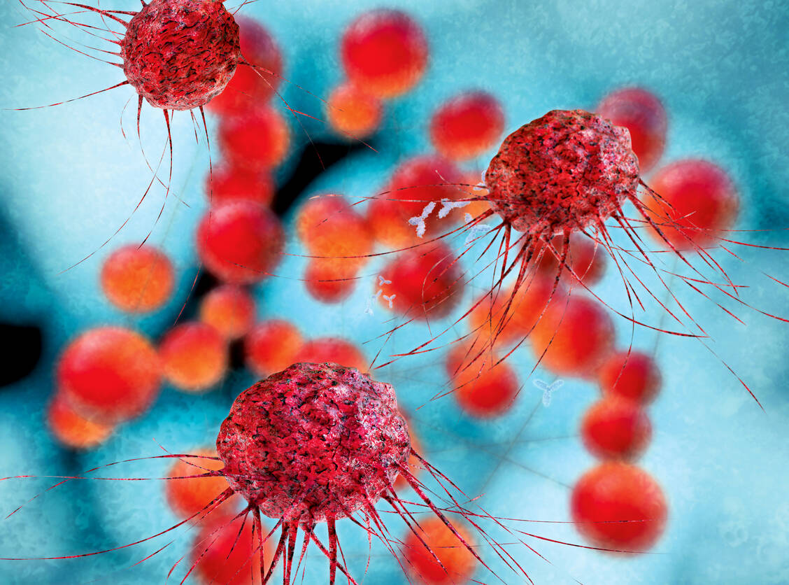 Krebserkrankungen gehören zu den häufigsten Indikationen, für die Biologicals eingesetzt werden.  / Foto: Fotolia/fotoliaxrender