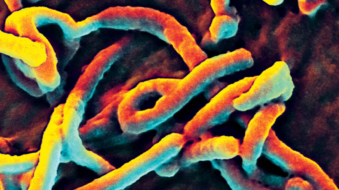 Für Ebola-Viren haben Forscher die Pathogenese im Detail aufgeklärt. / Foto: CDC/NIAID