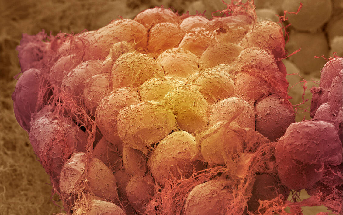 Im Fettgewebe häufen sich bei hyperkalorischer Ernährung  schnell entzündungsfördernde Zellen an. / Foto: Getty Images/Steve Gschmeissner/Science Photo Library
