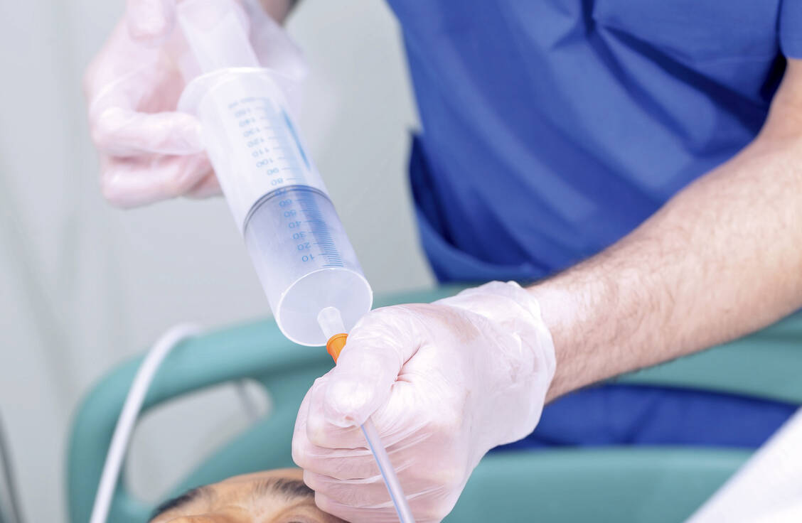 Kann ein Patient nicht mehr schlucken, muss er enteral über eine Sonde ernährt werden. Die Kost wird dabei unter Umgehung der oralen Aufnahme in den Magen-Darm-Trakt gebracht. / Foto: Fotolia/sudok1