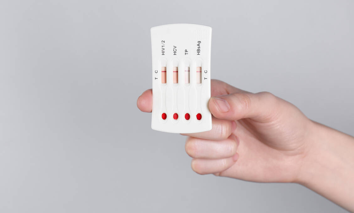 Manche Tests sind durchaus sinnvoll, von anderen raten Experte ab. / © Getty Images/Liudmila Chernetska