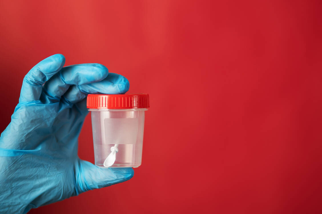 Eine standardisierte Stuhlprobe wurde von verschiedenen US-amerikanischen Mikrobiomtest-Anbietern ganz unterschiedlich ausgewertet. / © Getty Images/Yana Tikhonova