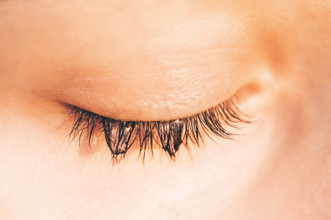 Die natürlicherweise im Wimpernkranz lebende Demodex-Milbe verklebt die Lidränder, wenn sie sich zu stark vermehrt.  / © Getty Images/Maria Korneeva