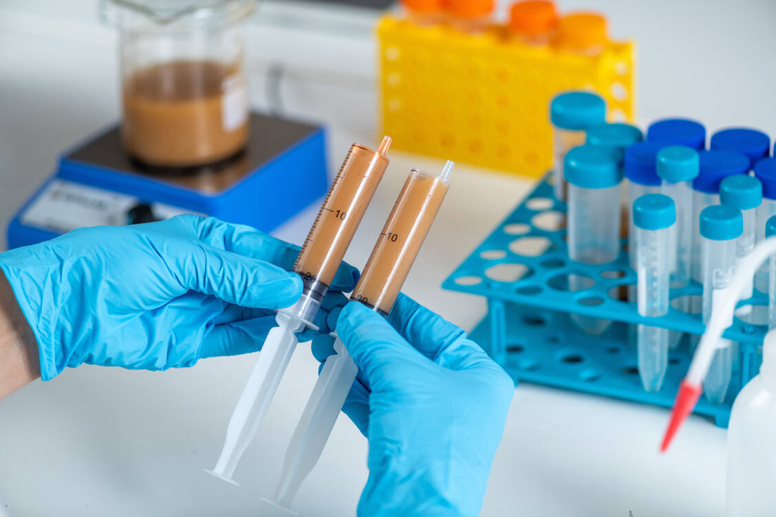 Eine Stuhltransplantation erfolgt beispielsweise als Einlauf einer homogenisierten Lösung in den Dickdarm. / © Adobe Stock/Microgen