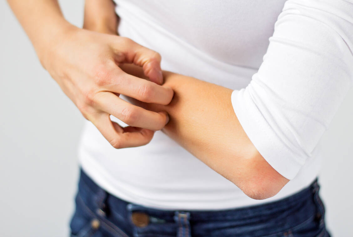 Keine Hautsymptome, aber trotzdem Juckreiz – die Diagnose ist nicht einfach / Foto: Shutterstock/Kaspars Grinvalds