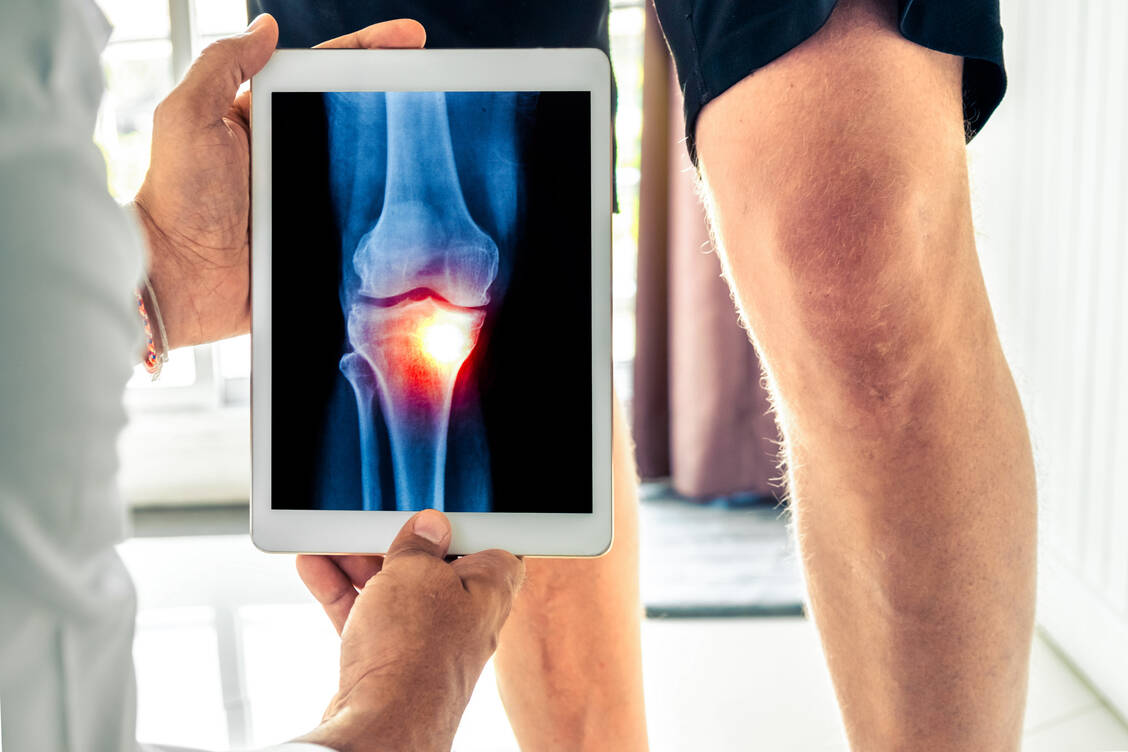 Gerade am Knie sind Operationen nicht einfach und ob die Probleme danach besser werden, ist keineswegs sicher. / Foto: Adobe Stock/steph photographies