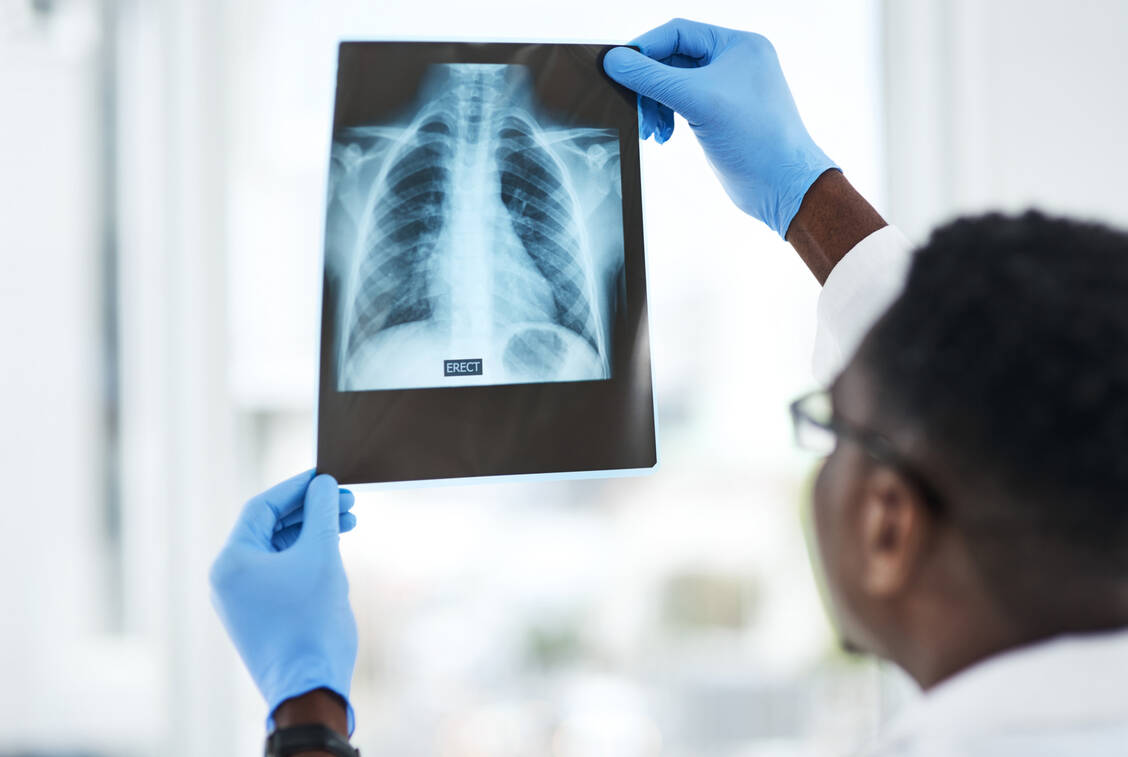 Aus der Medizin sind Röntgenuntersuchungen nicht mehr wegzudenken.  / Foto: Getty Images/PeopleImages