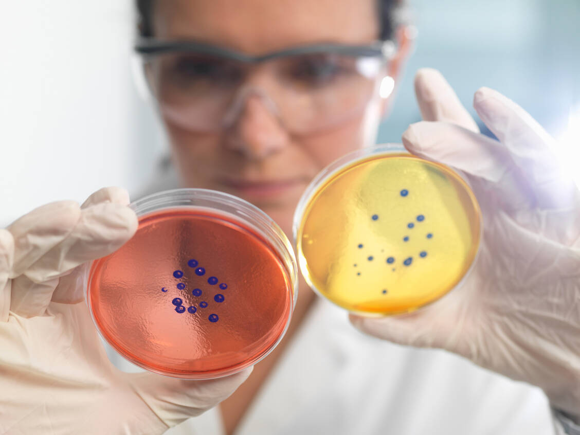 Nicht nur gegen Antibiotika nehmen Resistenzen zu, auch gegen Pilze. Die Therapie mit Antimykotika will also wohldurchdacht sein, um das Arzneistoff-Arsenal möglichst lange schlagkräftig zu halten.   / Foto: Getty Images/Andrew