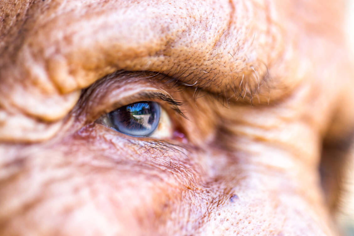 Das Glaukom schreitet zunächst meist völlig unbemerkt voran. Wird es nicht frühzeitig entdeckt und behandelt, kann Blindheit drohen. In Deutschland sind über 920.000 Menschen betroffen, die meisten erst ab einem Alter von 40 Jahren. / Foto: Getty Images/Pakin Songmor