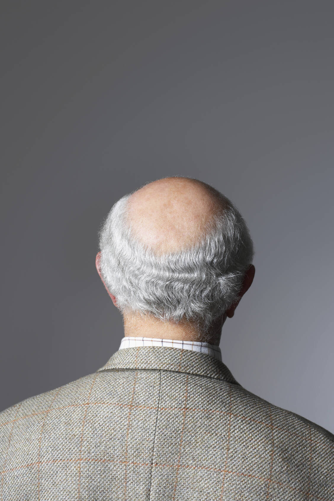 Eine Tonsur ist das typische Endstadium der androgenetischen Alopezie. / Foto: Getty Images/moodboard
