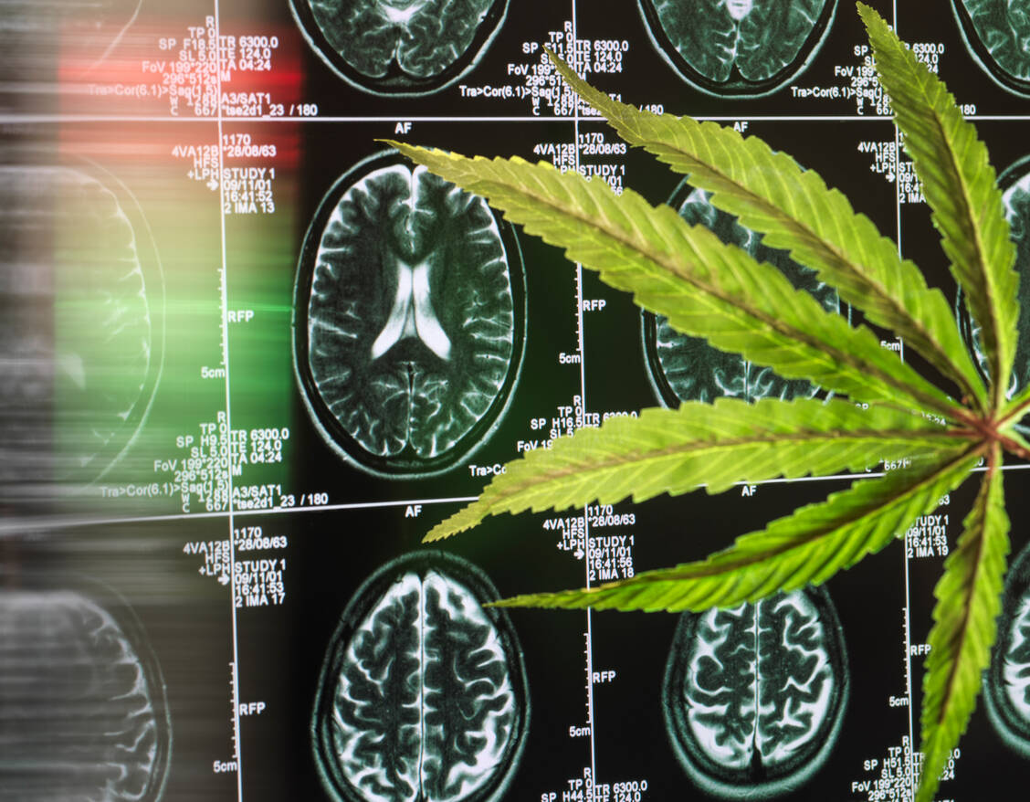 Die Forschenden vermuten, dass mehr Konsumenten auf medizinisches Cannabis umgestiegen sind. Dieses ist um einiges potenter als das auf dem Schwarzmarkt verkaufte. / © Getty Images/Andrew Brookes