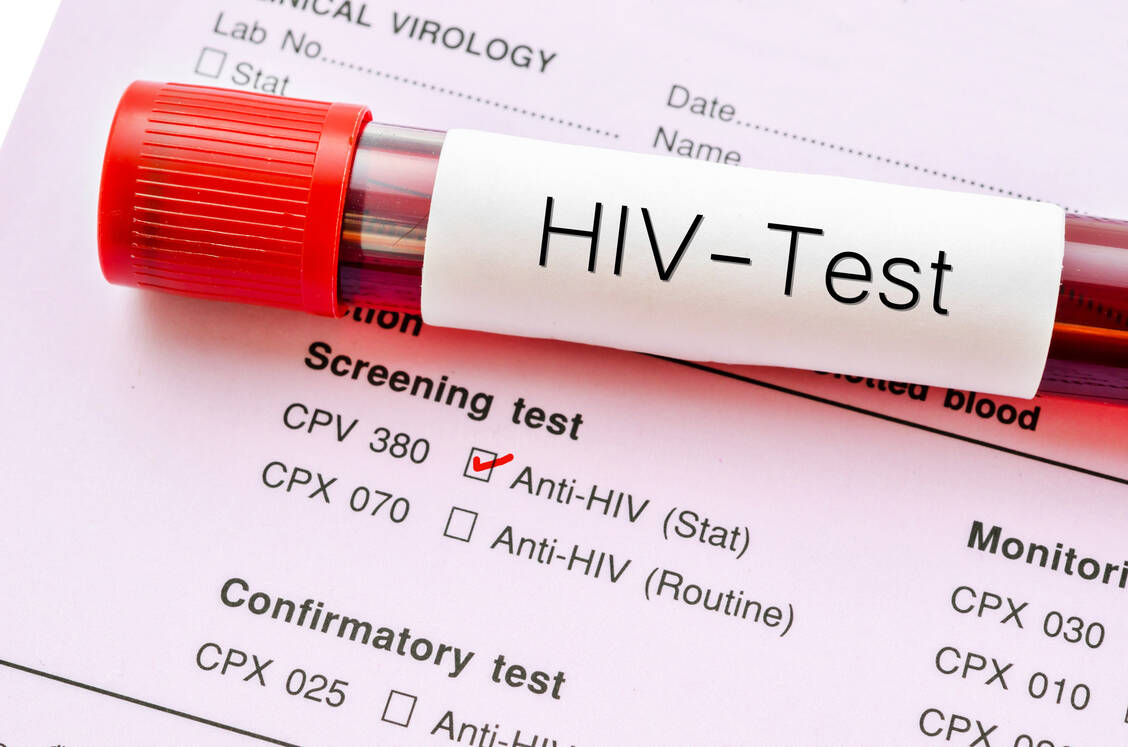 Antikörper gegen das HI-Virus können nicht sofort im Blut nachgewiesen werden – eine Infektion kann in der Regel erst etwa sechs Wochen nach der potenziellen Übertragung mit einem Labortest sicher ausgeschlossen werden. / © Getty Images/Gam1983