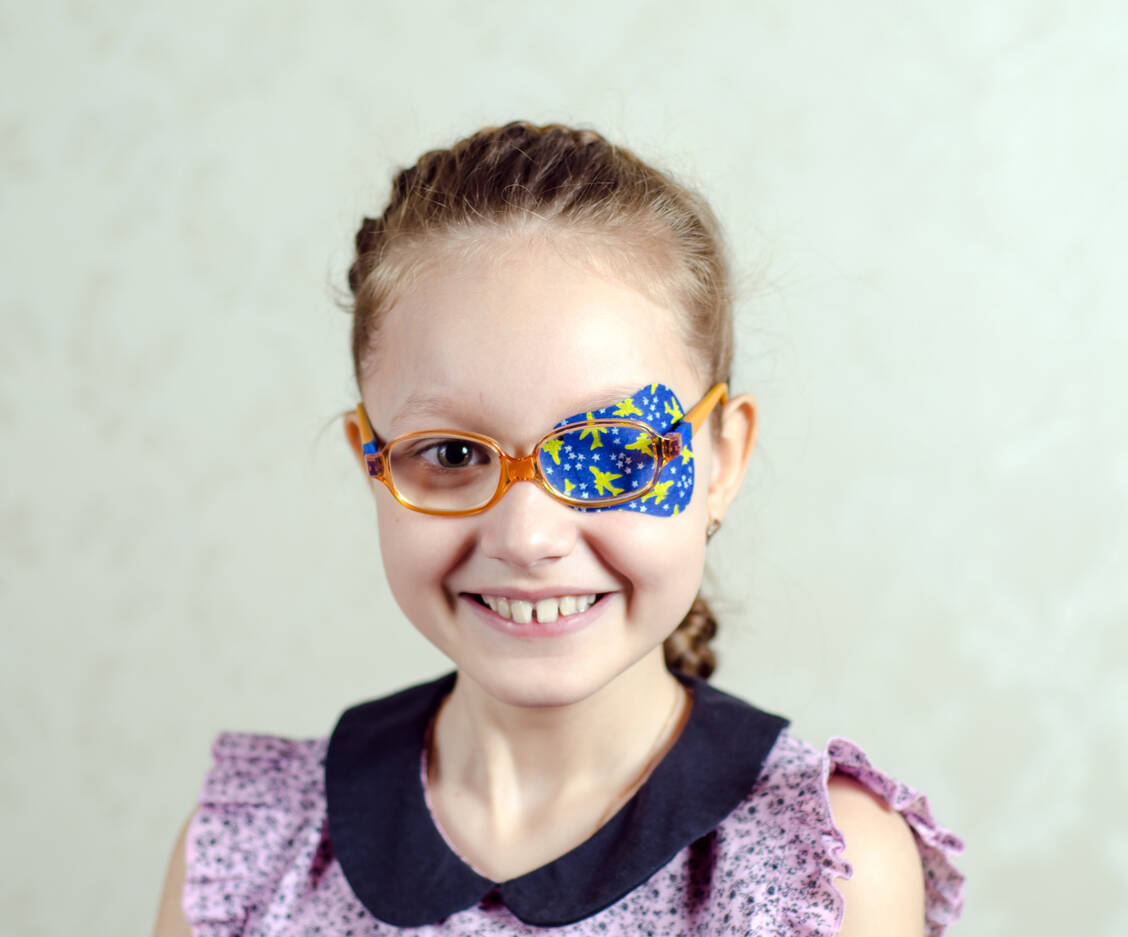 Die Behandlung der Amblyopie erfolgt meist durch eine Pflasterokklusion des besseren Auges, um das schwächere zu fördern. / Foto: Adobe Stock/sasha1806