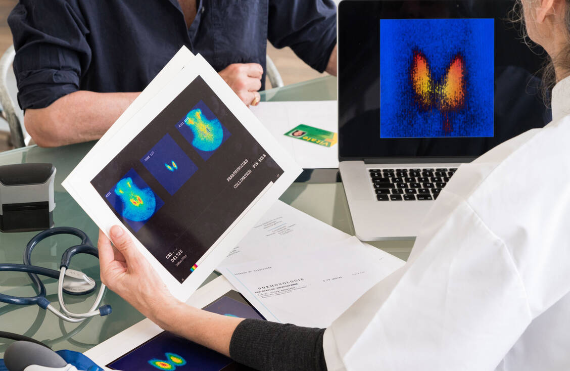Die Szintigrafie hilft bei der Unterscheidung zwischen den hormonproduzierenden heißen Knoten und den stoffwechselinaktiven kalten Knoten. / Foto: Your Photo Today
