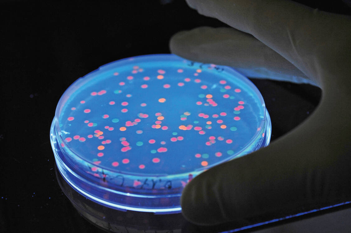 Salmonellen können schwerwiegende Durchfallerkrankungen auslösen. / Foto: picture alliance/dpa