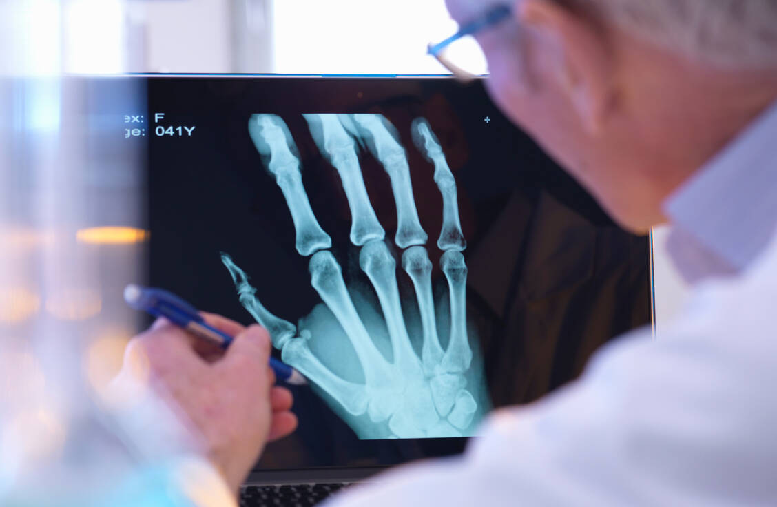 Rheuma-Patienten müssen kein Angst haben, dass ihre Erkrankung durch die Covid-19-Impfung wieder aufflammt. / Foto: Getty Images/Andrew Brookes