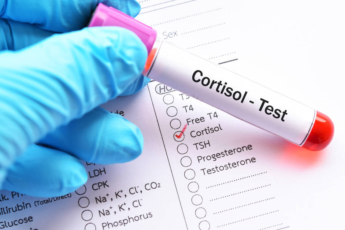 Die Messung des Cortisol-Spiegels im Blut gibt Hinweise auf eine Fehlfunktion der Nebennierenrinde. Allerdings können die Werte innerhalb von Minuten stark schwanken. / Foto: Adobe Stock/jarun011