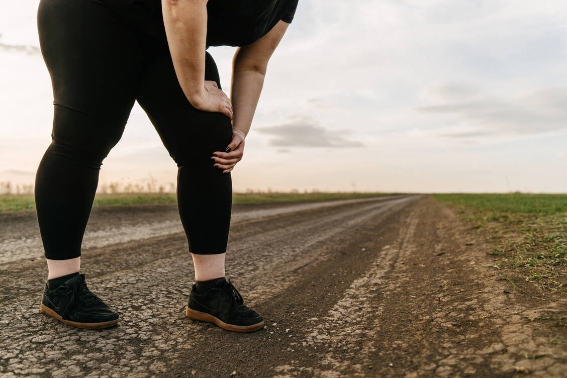 Ein Lipödem ist häufig sehr schmerzhaft. Laut einer kontrollierten Studie lindert eine die Liposuktion Schmerzen besser als eine konservative Behandlung. / © Getty Images/Vadym Petrochenko