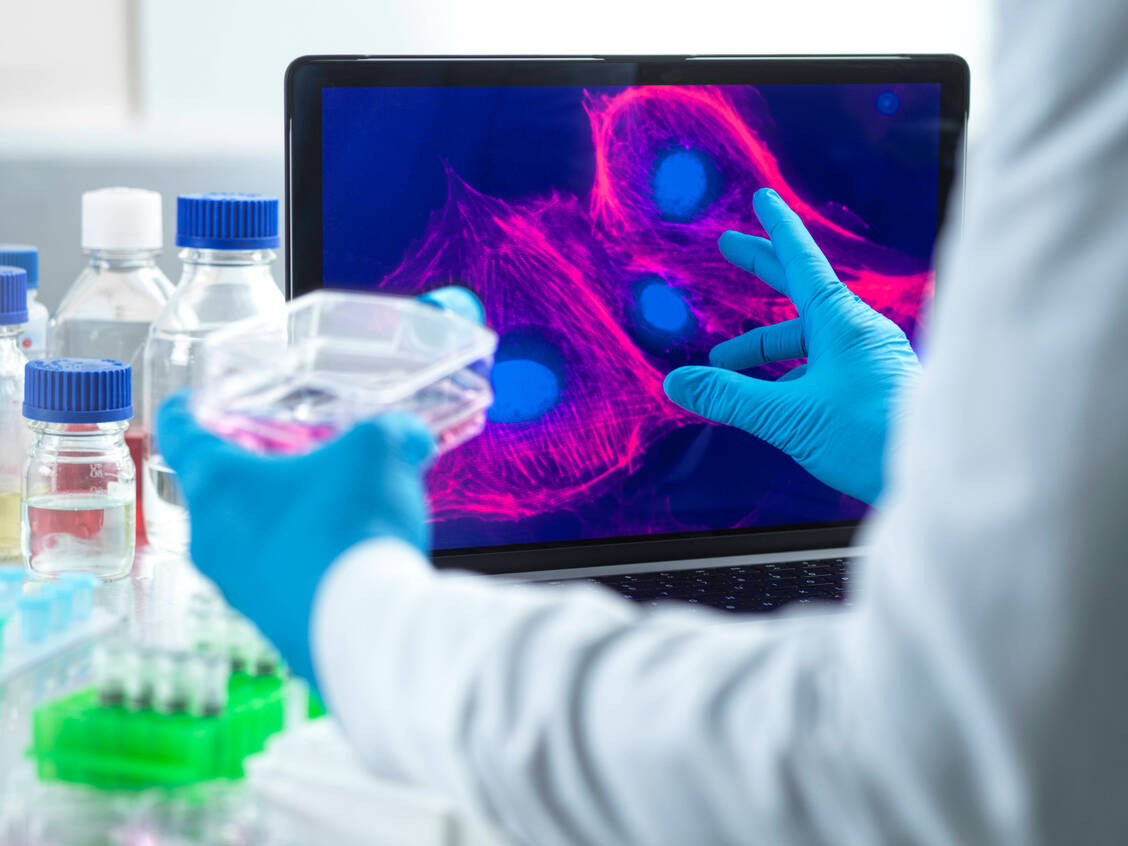 Bei einer allogenen hämatopoetischen Stammzelltransplantation kann eine lebensbedrohliche immunologische Reaktion auftreten. / © Imago Images/Westend61