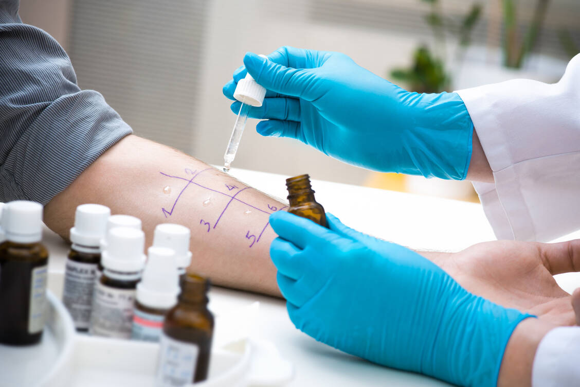 Pollenallergiker entwickeln häufig Kreuzallergien auf Nahrungsmittel. / Foto: Getty Images/AlexRaths