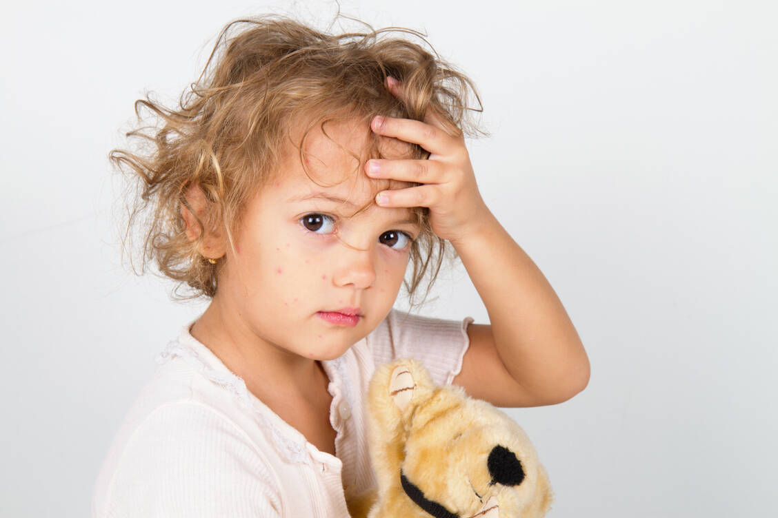 Masern müssten heute in Deutschland nicht mehr sein. Weil sie schwerwiegende Folgen haben können, existiert eine Impfpflicht. / Foto: Getty Images/angelacolac