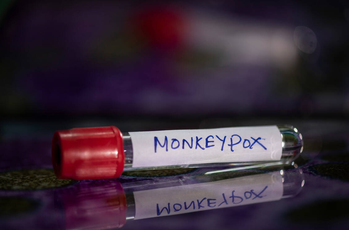 Affen sind zu Unrecht Namensgeber für die Krankheit. Deshalb sollen Affenpocken (engl. monkeypox) zukünftig Mpox heißen. / Foto: Getty Images/David Talukdar
