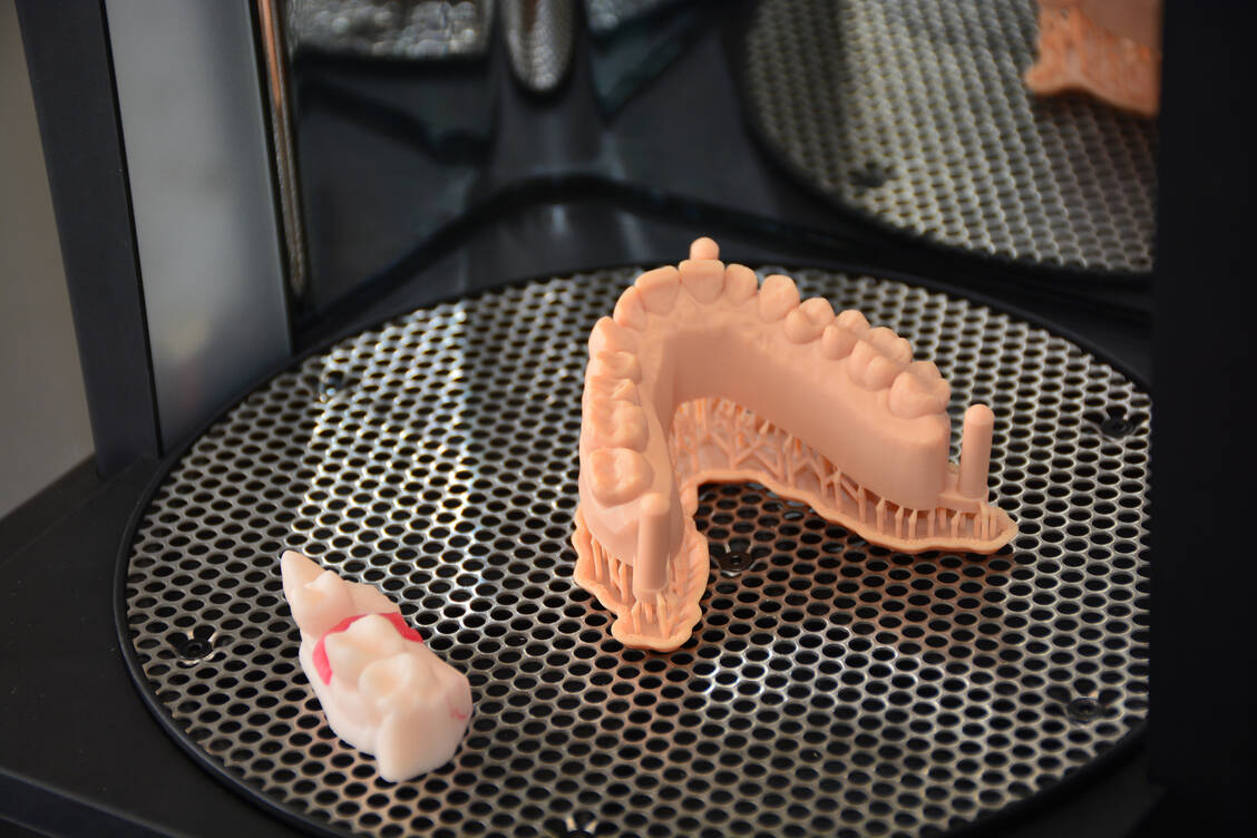 Von der Technologie des 3D-Druckverfahrens profitieren heute schon viele Patienten. / Foto: Adobe Stock/JLO_FOTO