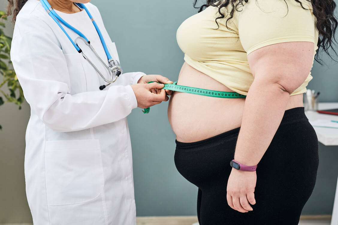 Auch der Taillenumfang sollte den Experten zufolge in die Diagnose einbezogen werden. / © Getty Images/peakSTOCK