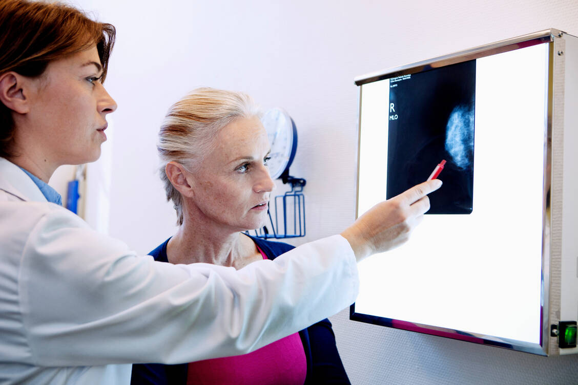 Bei der Mammografie wird das Brustgewebe auf Auffälligkeiten untersucht. / Foto: Getty Images/BSIP/UIG