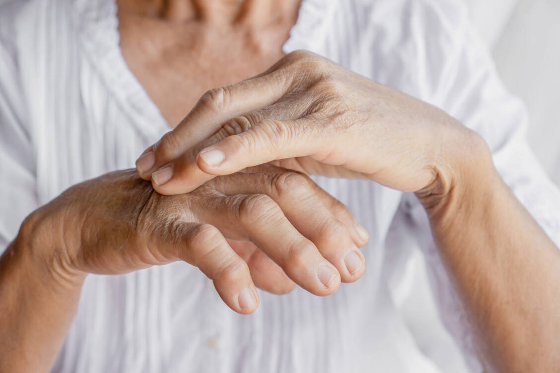 Ablagerungen von Harnsäurekristallen führen bei Gicht zu Schmerzen und Gelenkveränderungen. / Foto: Adobe Stock/doucefleur