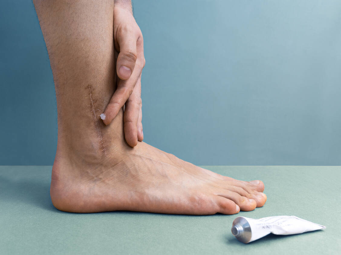 Auch wenn eine Narbe davon zeugt, dass sich der Mensch selbst reparieren und seine Schutzhülle wieder neu aufbauen kann: Narbengewebe ist Ersatzgewebe. / Foto: Adobe Stock/DiMar