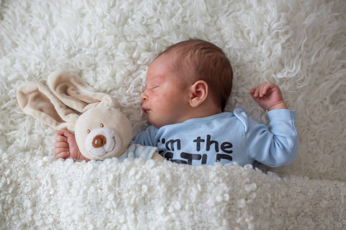 Hautausschläge können bei Babys unterschiedliche Ursachen haben und sollten, vor allem bei zusätzlichen Symptomen wie Fieber oder Abgeschlagenheit, ärztlich abgeklärt werden. / Foto: Adobe Stock/Tomsickova