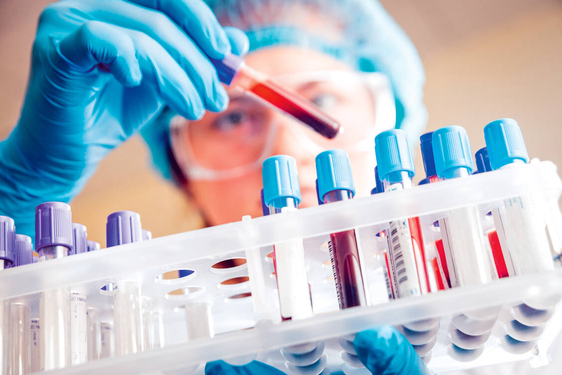 Ein erhöhter Hba<sub>1c</sub>-Wert kann die Lebenserwartung von Diabetes-Typ-2-Patienten verringern. / Foto: Shutterstock/Romaset