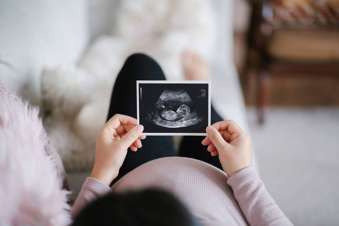 Gesetzlich versicherte Schwangere haben in der Regel Anspruch auf drei Basis-Ultraschalluntersuchungen. / © Getty Images/AsiaVision