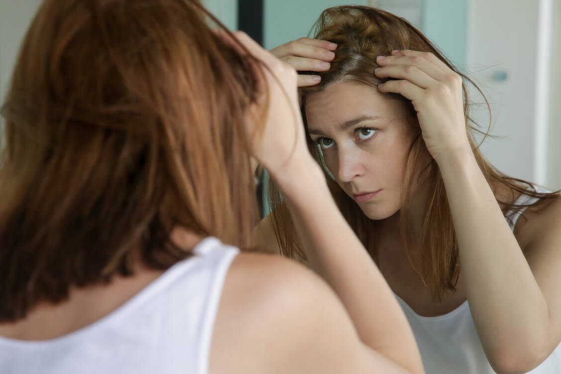 An welchen Stellen die Haare weniger werden, gibt einen ersten Hinweis auf die Ursache des Haarausfalls. / Foto: Adobe Stock/triocean
