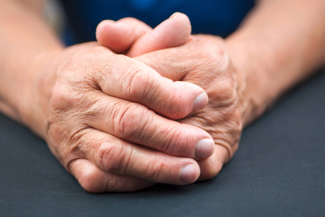 Bei Gelenkerkrankungen wie rheumatoider Arthritis kann die Beweglichkeit der Finger eingeschränkt sein, was das Zusammensetzen von Fertigspritzen erschwert. / Foto: Adobe Stock/hriana