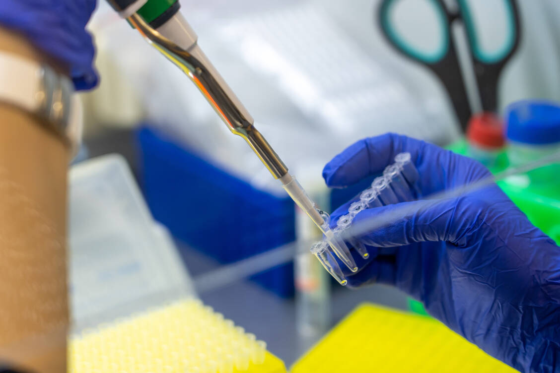 Das Affenpockenvirus wird mittels PCR-Testung nachgewiesen. / Foto: Adobe Stock/sommersby
