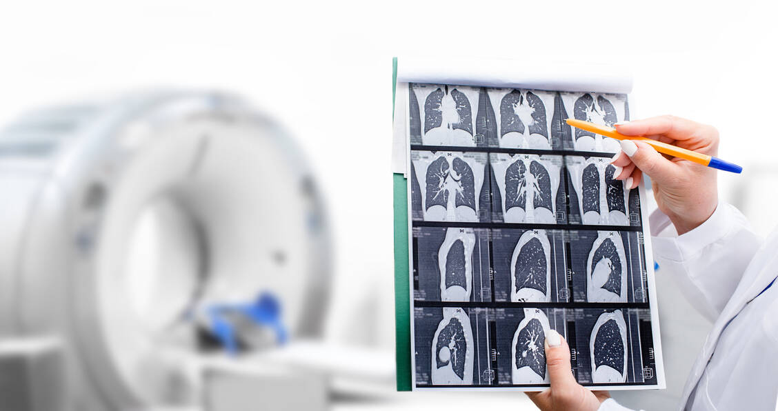 Bei einer CT werden Röntgenstrahlen genutzt, um dreidimensionale Schnittbilder des Körperinneren zu erzeugen.  / © Getty Images/Artemenko_Daria
