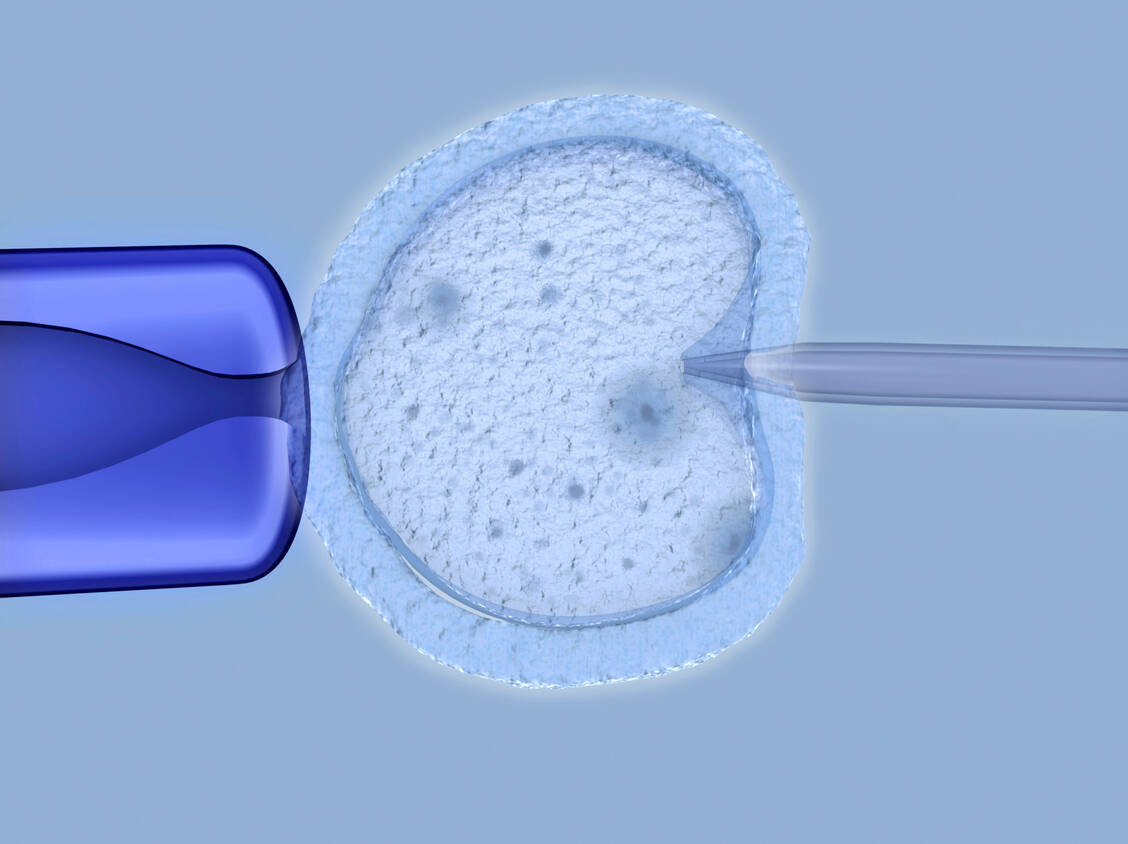 Bei der In-Vitro-Fertilisation (IVF) findet die Befruchtung der Eizelle mit den Samenzellen des Partners im Reagenzglas statt. / Foto: Getty Images/JUAN GARTNER