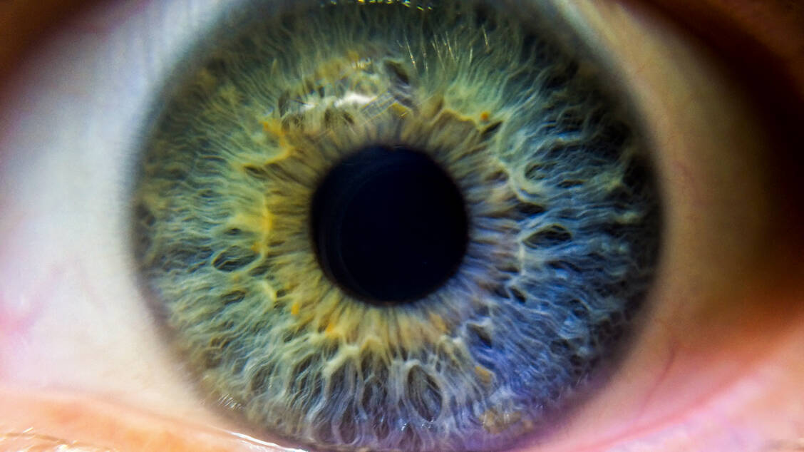 Dass ein Arzneimittel Nebenwirkungen am Auge auslösen kann, ist Patienten oft nicht bewusst. Hier ist die Beratung von PTA und Apotheker gefragt. / Foto: iStock/Mark_Kuiken