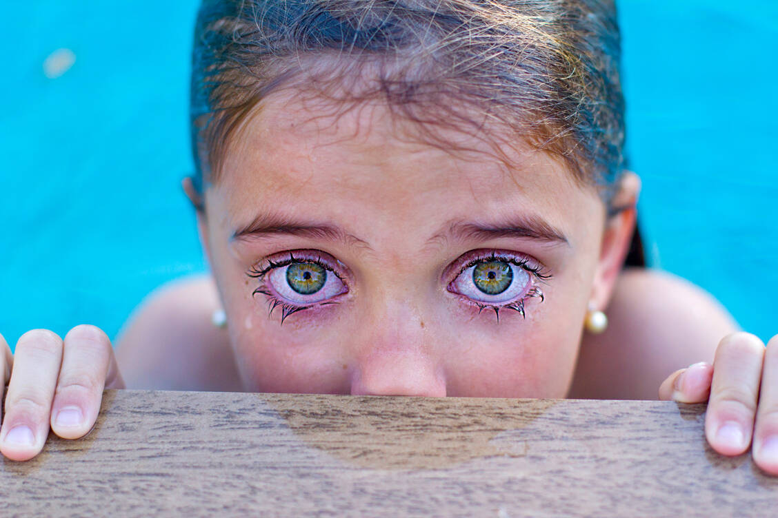 Hornhaut und Bindehaut sind sehr schmerzempfindlich. Eine Reizung beispielsweise durch Chlor im Schwimmbad wird daher sehr schnell wahrgenommen. / © Getty Images/Malú