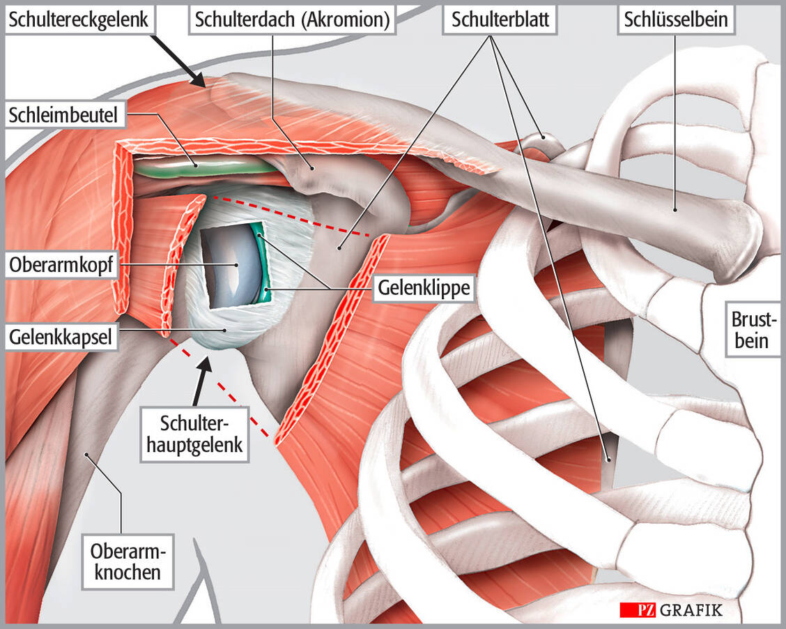 Maximale Flexibilität zeichnet die Schulter aus: Das Hauptgelenk zwischen Oberarmknochen und Schulterblatt erlaubt dem Arm Bewegungen in fast jede Richtung. Das Schulterdach, ein Fortsatz des Schulterblatts, bildet mit dem Schlüsselbein das Schultergelenk. Stabilisiert wird das Schulterblatt jedoch einzig durch die umgebende Muskulatur. Daher ist es auch selbst so mobil. / Foto: PZ/Stephan Spitzer