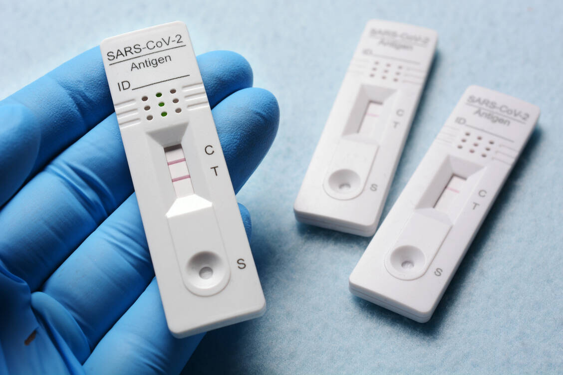 Ist ein SARS-CoV-2-Antigentest positiv, haben die Betroffenen Anspruch auf eine bestätigende PCR-Testung. / Foto: Adobe Stock/Dan Race