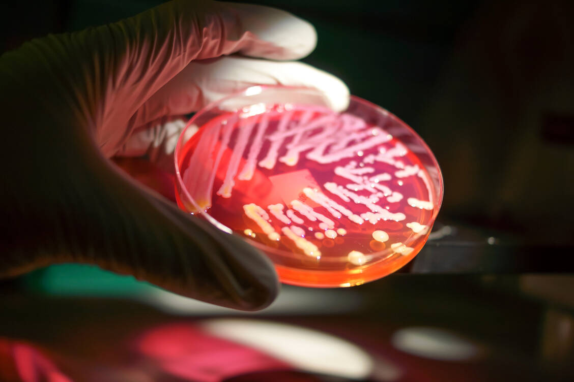 Werden Antibiotika ohne einen triftigen Grund, zu oft, über einen zu langen Zeitraum oder unsachgemäß angewendet, begünstigt das die Entstehung und Verbreitung von resistenten Erregern. / © Getty Images/Rodolfo Parulan Jr.