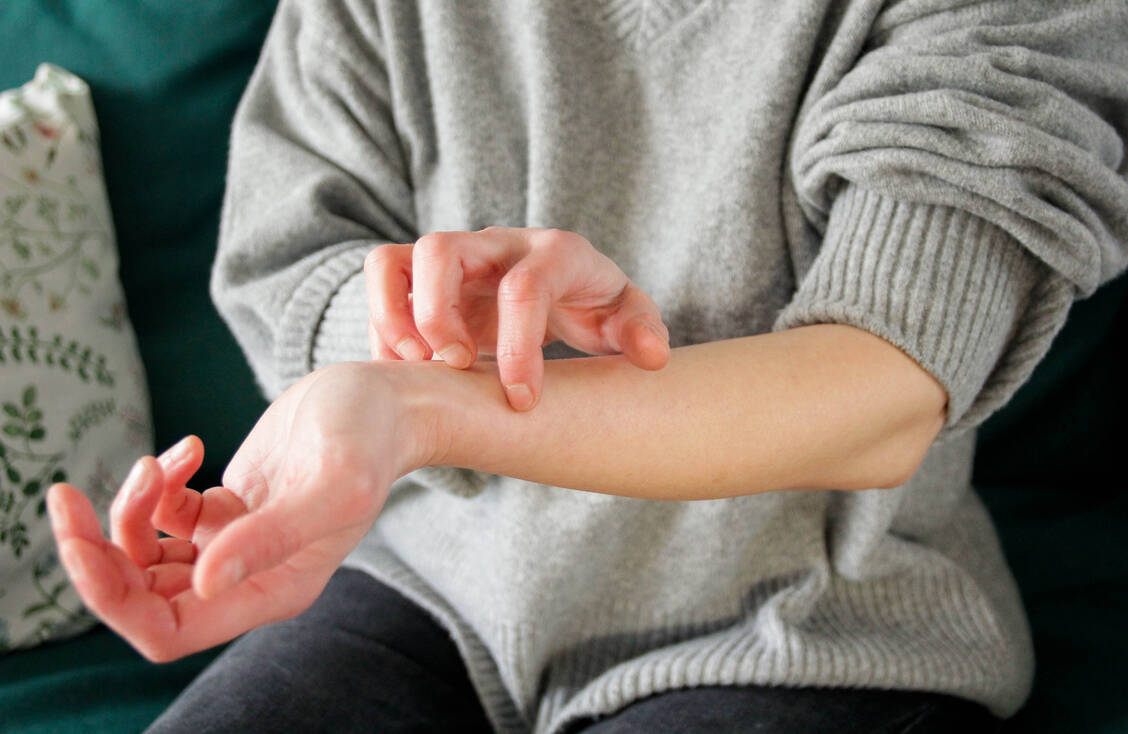 Der neue Antikörper Nemolizumab ist unter anderem zur Therapie der atopischen Dermatitis zugelassen. Er blockiert den Rezeptor für das Zytokin IL-31, das etwa Juckreiz auslöst. / © Getty Images/Kinga Krzeminska