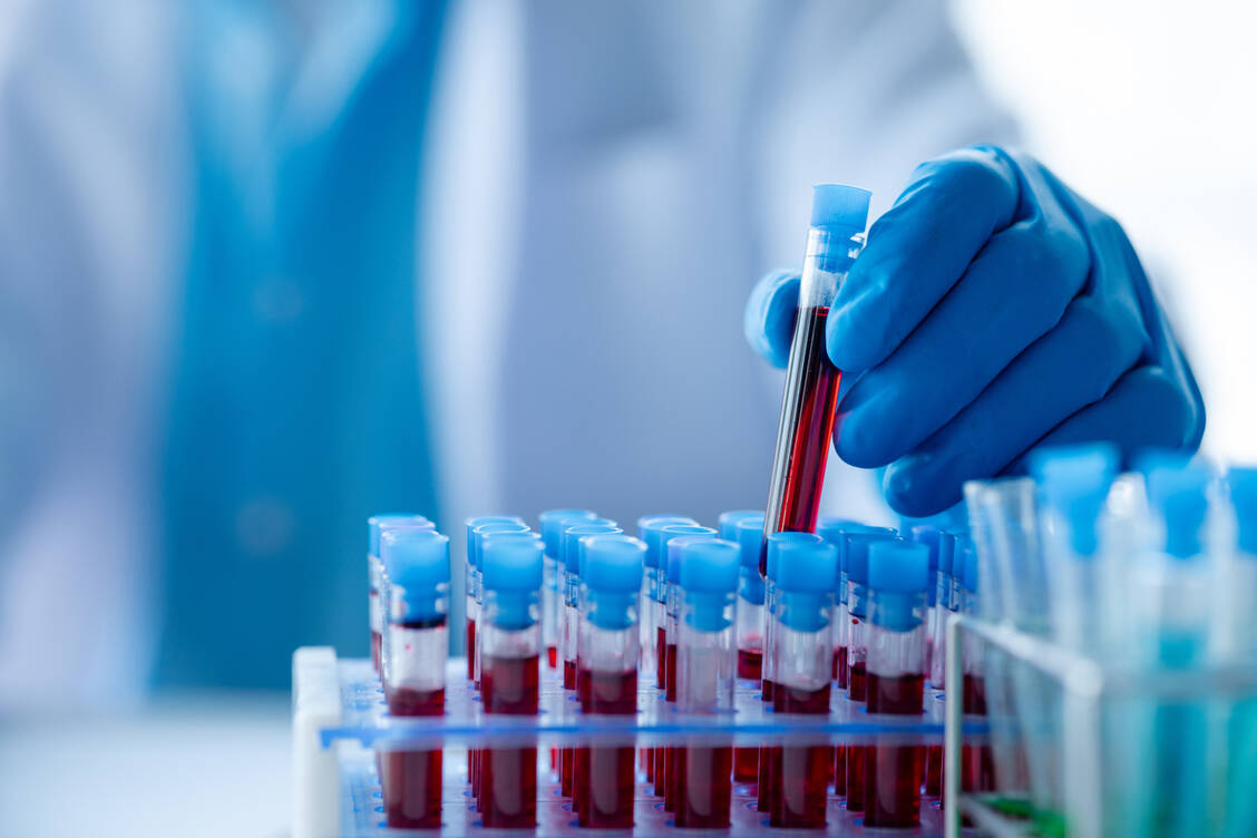 Die Bestimmung von Gesundheitswerten ist bei begründetem Verdacht auf eine Erkrankung oder einen Mangel sinnvoll. / © Adobe Stock/kamiphotos
